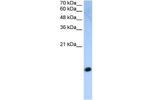 HIST2H2AC antibody used at 2. (HIST2H2AC antibody  (Middle Region))