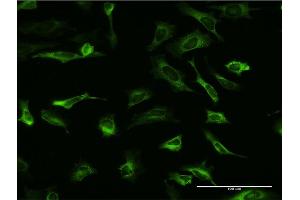 Immunofluorescence of monoclonal antibody to PCBP2 on HeLa cell. (PCBP2 antibody  (AA 1-362))