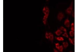 STMN4 antibody  (Internal Region)