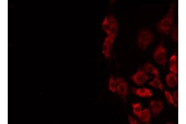 STMN4 antibody  (Internal Region)