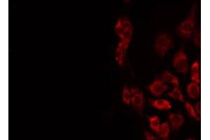 ABIN6275611 staining Hela by IF/ICC. (STMN4 antibody  (Internal Region))