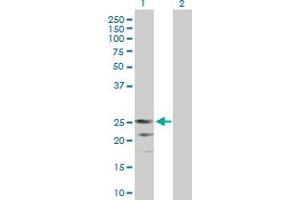 Western Blot analysis of CD70 expression in transfected 293T cell line by CD70 MaxPab polyclonal antibody. (CD70 antibody  (AA 1-193))