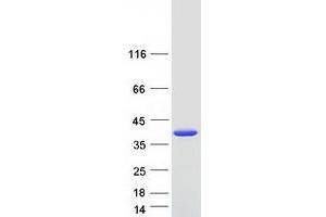 Validation with Western Blot (SULT1E1 Protein (Myc-DYKDDDDK Tag))