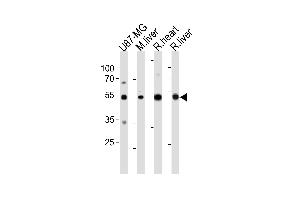 GPT Antibody (N-term ) (ABIN391679 and ABIN2841588) western blot analysis in U87-MG cell line , mouse liver ,and rat heart and liver tissue lysates (35 μg/lane). (ALT antibody  (N-Term))