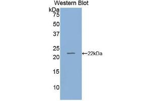 Western blot analysis of the recombinant protein. (RBP4 antibody  (AA 19-201))