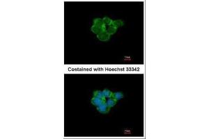 ICC/IF Image Immunofluorescence analysis of methanol-fixed A431, using Nicotinic Acetylcholine Receptor alpha 3, antibody at 1:500 dilution. (CHRNA3 antibody  (Center))