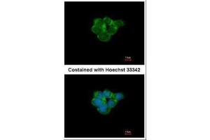 ICC/IF Image Immunofluorescence analysis of methanol-fixed A431, using Nicotinic Acetylcholine Receptor alpha 3, antibody at 1:500 dilution. (CHRNA3 antibody  (Center))