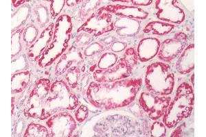 Human Kidney: Formalin-Fixed, Paraffin-Embedded (FFPE) (GPR81 antibody  (Cytoplasmic Domain))