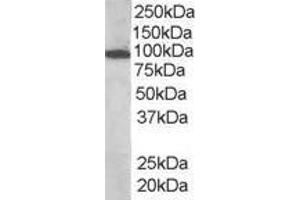 ABIN185278 (1 µg/mL) staining of human bone marrow lysate (35 µg protein in RIPA buffer). (VAV3 antibody  (Internal Region))