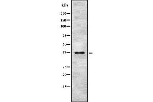 Western blot analysis of PINX1 using NIH-3T3 whole cell lysates