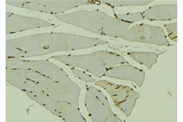 AKAP6 antibody  (C-Term)