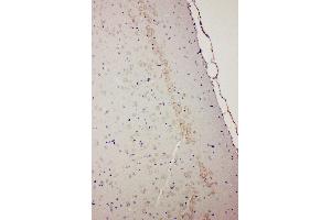 Anti-Dopamine Receptor D1 antibody, IHC(P) IHC(P): Rat Brain Tissue (Dopamine Receptor d1 antibody  (Middle Region))