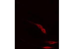 ABIN6267403 staining HepG2 cells by IF/ICC. (Phospholipase C gamma 2 antibody  (pTyr753))
