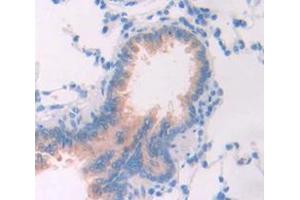 Figure. (FGL2 antibody  (AA 263-424))