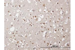 Immunoperoxidase of purified MaxPab antibody to ZNF483 on formalin-fixed paraffin-embedded human cerebral cortex. (ZNF483 antibody  (AA 1-244))