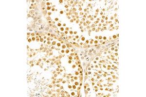 Immunohistochemistry of paraffin embedded rat testis using BPTF (ABIN7073234) at dilution of 1:1000 (400x lens) (BPTF antibody)