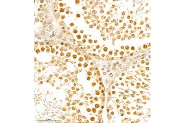 BPTF antibody