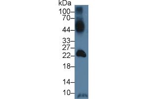 Western Blot; Sample: Mouse Testis lysate; Primary Ab: 3µg/ml Rabbit Anti-Human GLUT14 Antibody Second Ab: 0. (SLC2A14 antibody  (AA 1-105))