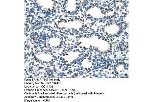 Human Lung (ARIH2 antibody  (N-Term))