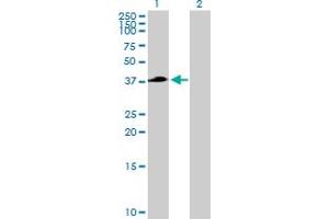 Western Blot analysis of TFB2M expression in transfected 293T cell line by TFB2M MaxPab polyclonal antibody. (TFB2M antibody  (AA 1-396))