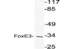 Western blot analysis of FOXE3 in extracts from K562 cell using FOXE3 / FKHL12 antibody (FOXE3 antibody)