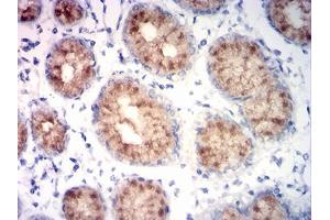 Immunohistochemical analysis of paraffin-embedded stomach tissues using MUC5AC mouse mAb with DAB staining.