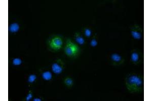 Anti-FSHB mouse monoclonal antibody (ABIN2453054) immunofluorescent staining of COS7 cells transiently transfected by pCMV6-ENTRY FSHB (RC214616). (FSHB antibody)