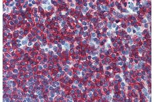 Immunohistochemistry staining of human small intestine (paraffin-embedded sections) with anti-CD45RB (MEM-55). (CD45RB antibody)