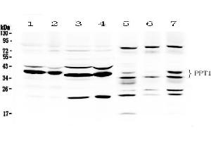 Western blot analysis of PPT1 using anti- PPT1 antibody . (PPT1 antibody  (C-Term))