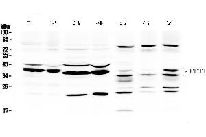 Western blot analysis of PPT1 using anti- PPT1 antibody . (PPT1 antibody  (C-Term))