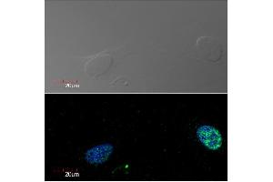 Immunocytochemistry detection of Ki-67 in U2OS cell line (human osteosarcoma) using monoclonal antibody Ki-67 (green). (Ki-67 antibody)