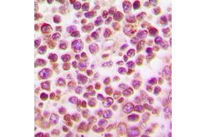 Immunohistochemical analysis of IRF4 staining in human tonsil formalin fixed paraffin embedded tissue section. (IRF4 antibody  (Center))