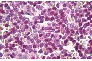 Image no. 1 for anti-CDC28 Protein Kinase Regulatory Subunit 1B (CKS1B) (C-Term) antibody (ABIN1493317) (CKS1 antibody  (C-Term))
