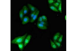 anti-Kinase D-Interacting Substrate, 220kDa (KIDINS220) (AA 1077-1370) antibody