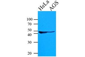 The Cell lysates of HeLa and AGS (35ug) were resolved by SDS-PAGE, transferred to PVDF membrane and probed with anti-human KRT18 (1:1000). (Cytokeratin 18 antibody  (AA 79-430))