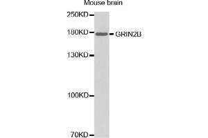 Western blot analysis of extracts of mouse brain, using GRIN2B antibody (ABIN2974534). (GRIN2B antibody)