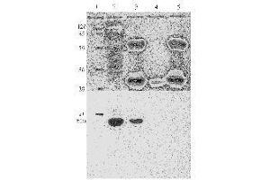Western Blotting (WB) image for anti-Human Papilloma Virus 11 E7 (HPV-11 E7) (AA 36-70) antibody (ABIN781777) (Human Papilloma Virus 11 E7 (HPV-11 E7) (AA 36-70) antibody)