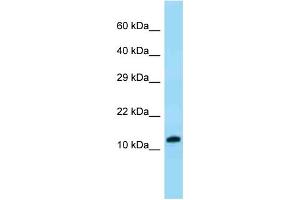 WB Suggested Anti-VKORC1 Antibody Titration: 1. (VKORC1 antibody  (N-Term))