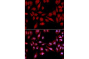 Immunofluorescence analysis of U2OS cell using PSMA2 antibody. (PSMA2 antibody  (AA 1-234))