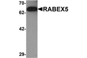 Western blot analysis of RABEX5 in rat brain tissue lysate with RABEX5 antibody at 1 μg/ml. (RABGEF1 antibody  (Center))