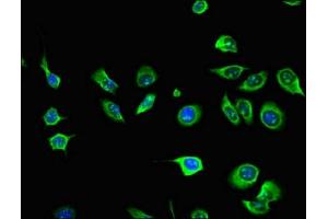 Immunofluorescent analysis of A549 cells using ABIN7156703 at dilution of 1:100 and Alexa Fluor 488-congugated AffiniPure Goat Anti-Rabbit IgG(H+L) (AIM2 antibody  (AA 81-326))