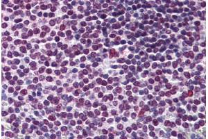 Human Spleen: Formalin-Fixed, Paraffin-Embedded (FFPE) (RCC1 antibody  (AA 312-421))