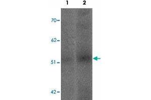 Western blot analysis of SLC39A14 in human spleen tissue lysate with SLC39A14 polyclonal antibody  at (1) 1 and (2) 2 ug/mL.