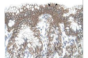 Image no. 1 for anti-threonyl-tRNA Synthetase (TARS) (AA 51-100) antibody (ABIN341310) (TARS antibody  (AA 51-100))