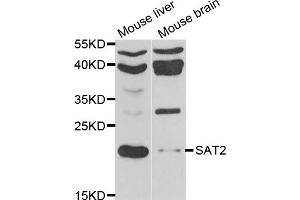 Western blot analysis of extracts of various cell lines, using SAT2 antibody. (SAT2 antibody)