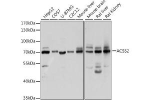 Western blot analysis of extracts of various cell lines, using ACSS2 antibody (ABIN2560918) at 1:1000 dilution. (ACSS2 antibody)