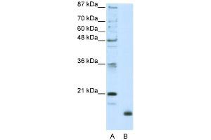 WB Suggested Anti-RPL32 Antibody Titration:  2. (RPL32 antibody  (N-Term))