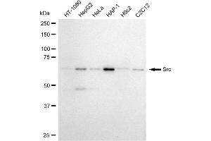 Western blotting analysis using Src antibody (ABIN7800054). (Recombinant Src antibody)