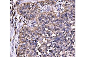 IHC analysis of Drebrin/DBN1 using anti-Drebrin/DBN1 antibody (ABIN7602638). (DBN1 antibody  (AA 9-649))