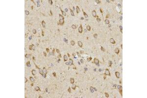 Immunohistochemistry of paraffin-embedded rat brain tissue using GRM8 antibody at dilution of 1:200 (x400 lens)